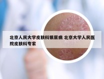 北京人民大学皮肤科银屑病 北京大学人民医院皮肤科专家