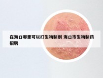 在海口哪里可以打生物制剂 海口市生物制药招聘