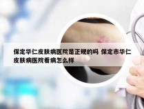 保定华仁皮肤病医院是正规的吗 保定市华仁皮肤病医院看病怎么样