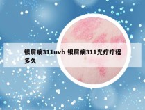 银屑病311uvb 银屑病311光疗疗程多久