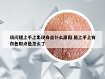 请问腿上手上出现白点什么原因 腿上手上有白色斑点是怎么了