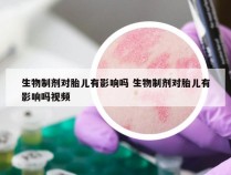 生物制剂对胎儿有影响吗 生物制剂对胎儿有影响吗视频