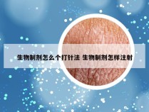 生物制剂怎么个打针法 生物制剂怎样注射