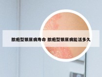 脓疱型银屑病寿命 脓疱型银屑病能活多久