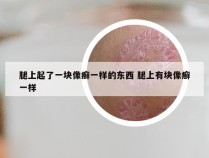 腿上起了一块像癣一样的东西 腿上有块像癣一样