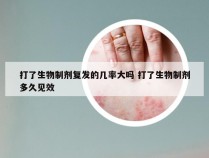 打了生物制剂复发的几率大吗 打了生物制剂多久见效