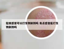 轻微感冒可以打生物制剂吗 有点感冒能打生物制剂吗