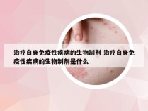 治疗自身免疫性疾病的生物制剂 治疗自身免疫性疾病的生物制剂是什么