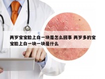 两岁宝宝脸上白一块是怎么回事 两岁多的宝宝脸上白一块一块是什么