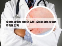 成都银康银屑医院怎么样 成都银康银屑病医院有限公司