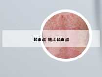 长白点 腿上长白点