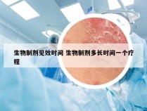 生物制剂见效时间 生物制剂多长时间一个疗程