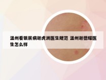 温州看银屑病谢虎洲医生规范 温州谢德耀医生怎么样