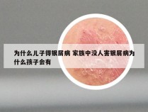 为什么儿子得银屑病 家族中没人害银屑病为什么孩子会有