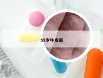 55岁牛皮癣