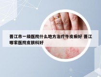 晋江市一级医院什么地方治疗牛皮癣好 晋江哪家医院皮肤科好