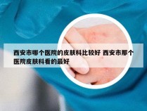 西安市哪个医院的皮肤科比较好 西安市那个医院皮肤科看的最好