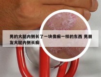 男的大腿内侧长了一块像癣一样的东西 男朋友大腿内侧长癣