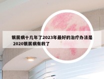 银屑病十几年了2023年最好的治疗办法是 2020银屑病有救了