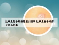 肚子上起小红癣是怎么回事 肚子上有小红疹子怎么回事