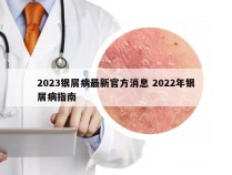 2023银屑病最新官方消息 2022年银屑病指南