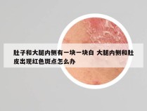 肚子和大腿内侧有一块一块白 大腿内侧和肚皮出现红色斑点怎么办