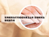 生物制剂治疗天疱疮效果怎么样 生物制剂治狼疮副作用