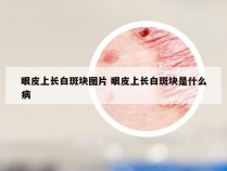 眼皮上长白斑块图片 眼皮上长白斑块是什么病