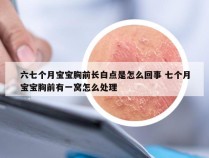 六七个月宝宝胸前长白点是怎么回事 七个月宝宝胸前有一窝怎么处理