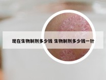 现在生物制剂多少钱 生物制剂多少钱一针