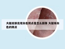 大腿皮肤出现白色斑点是怎么回事 大腿有白色的斑点