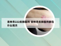 吉林市222皮肤医院 吉林市皮肤医院都在什么地方