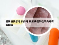 银屑病偶尔吃羊肉吗 银屑病偶尔吃羊肉吗有影响吗