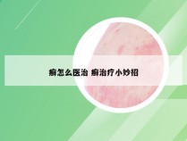 癣怎么医治 癣治疗小妙招