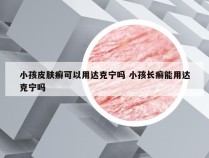 小孩皮肤癣可以用达克宁吗 小孩长癣能用达克宁吗