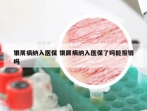 银屑病纳入医保 银屑病纳入医保了吗能报销吗