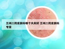 兰州二院皮肤科哪个大夫好 兰州二院皮肤科专家