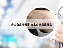 身上白点咋回事 身上白点点是什么