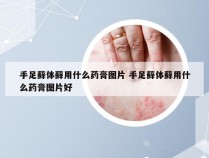 手足藓体藓用什么药膏图片 手足藓体藓用什么药膏图片好