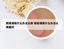 银屑病用什么办法止痒 银屑病用什么办法止痒最好