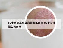 50多岁腿上有白点是怎么回事 50岁女性腿上长白点