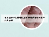 银屑病补什么最好的方法 银屑病补什么最好的方法呢