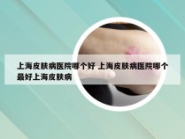 上海皮肤病医院哪个好 上海皮肤病医院哪个最好上海皮肤病