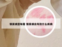 银屑病意味着 银屑病会导致什么疾病