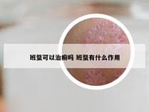 班蝥可以治癣吗 班蝥有什么作用