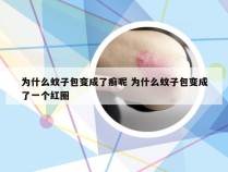 为什么蚊子包变成了癣呢 为什么蚊子包变成了一个红圈