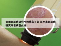 郑州银屑病研究所收费高不高 郑州市银屑病研究所看病怎么样