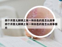 四个月婴儿脚膊上有一块白色的是怎么回事 四个月婴儿脚膊上有一块白色的是怎么回事图片