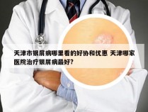 天津市银屑病哪里看的好协和优惠 天津哪家医院治疗银屑病最好?