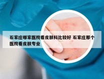 石家庄哪家医院看皮肤科比较好 石家庄那个医院看皮肤专业